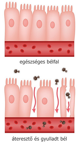 LGG-probiotikum-komplex áteresztő bél