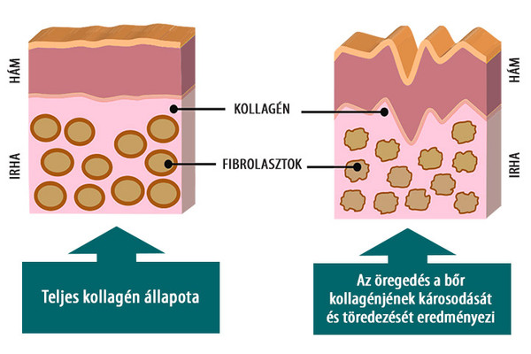 Az életkorral járó csökkent kollagénszintézis