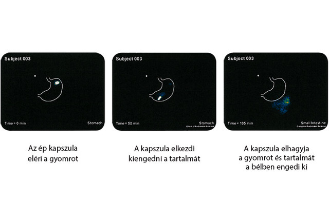A DRcaps® kapszulák lebomlását humán tesztalanyoknál bizonyították